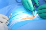 Macro Shot Of Doctors Making A Suture In Operation Room.  Focus Stock Photo