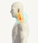 Neck Painful - Cervica Spine Skeleton X-ray, 3d Illustration Stock Photo