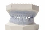 Dental Model Stock Photo