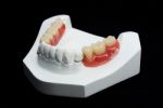 Dentures Stock Photo