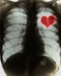 Broken Heart On Black X-ray Film Stock Photo