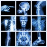 Collection X-ray Part Of Human (version 2) Stock Photo