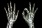 X-ray Both Hands With Ok Sign Stock Photo