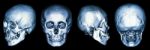 Ct Scan Of Human Skull And 3d Stock Photo