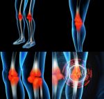 Human Knee Pain With The Anatomy Of A Skeleton Leg Stock Photo