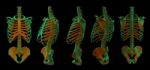 3d Illustration Of  Walking Fire Skeleton By X-rays On Backgroun Stock Photo