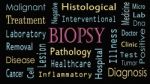 Biopsy Concept Word Cloud On Black Background Stock Photo