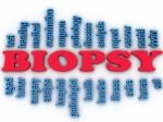 3d Imagen Biopsy Concept Word Cloud Background Stock Photo