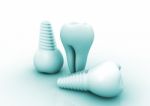 Dental Implant Stock Photo