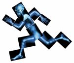 Marathon (human Bone Is Running) ,(whole Body X-ray : Head ,neck ,shoulder ,arm ,elbow ,forearm ,hand ,finger ,joint ,thorax ,abdomen ,back,pelvis ,hip ,thigh ,leg ,knee ,foot ,heel) Stock Photo