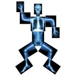 Aerobic Dance(human Bone Is Dancing),(whole Body X-ray : Head ,neck ,thorax ,shoulder ,arm ,elbow ,forearm ,hand ,finger ,joint ,thorax ,abdomen ,back,pelvis ,hip ,thigh ,leg ,knee ,foot ,heel ,ankle) Stock Photo