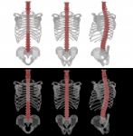 3d Rendering Illustration Of The Human Spine Stock Photo