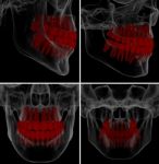Medical Illustration Of The Tooth On Background Stock Photo