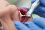 Close-up Medical Dentist Procedure Of Teeth Polish Stock Photo