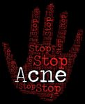 Stop Acne Shows Warning Sign And Blackheads Stock Photo