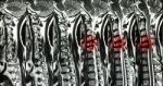 Cervical Spondylosis With Disc Herniation ( Mri Of Cervical Spine : Show Cervical Spondylosis With Disc Herniation Compress Spinal Cord ( Myelopathy ) ) Stock Photo