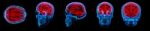 3d Rendering Human Brain X Ray Stock Photo