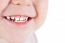 Toddler's Mouth Smiling Closeup
