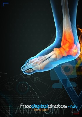 3d Illustration Of Ankle Pain By X- Ray On Background Stock Image