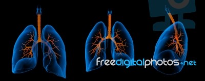 3d Medical Illustration - Lungs With Visible Bronchi Stock Image
