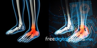 3d Render Human Foot Pain With The Anatomy Of A Skeleton Foot Stock Image