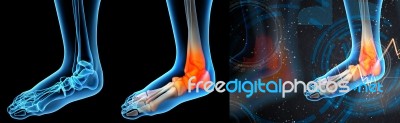 3d Render Illustration Of The Ankle Pain Stock Image
