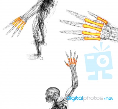 3d Render Medical Illustration Of The Metacarpal Bone Stock Image