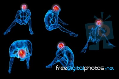 3d Rendered Human Of A Sitting - Headache Stock Image