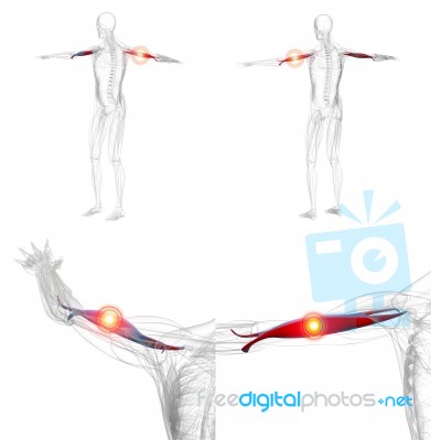 3d Rendering Illustration Of Red And Pain Biceps Muscle X-ray Co… Stock Image