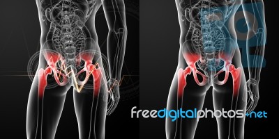 3d Rendering Medical Illustration Of A Painful Hip Joint Stock Image