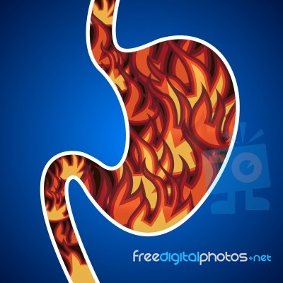Acid In The Stomach Stock Image