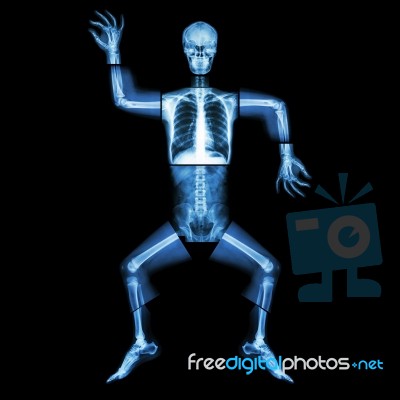 Aerobic Dance(human Bone Is Dancing),(whole Body X-ray : Head ,neck ,thorax ,shoulder ,arm ,elbow ,forearm ,hand ,finger ,joint ,thorax ,abdomen ,back,pelvis ,hip ,thigh ,leg ,knee ,foot ,heel ,ankle) Stock Photo