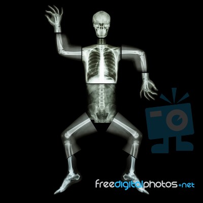 Aerobic Dance(human Bone Is Dancing),(whole Body X-ray : Head ,neck ,thorax ,shoulder ,arm ,elbow ,forearm ,hand ,finger ,joint ,thorax ,abdomen ,back,pelvis ,hip ,thigh ,leg ,knee ,foot ,heel ,ankle) Stock Photo