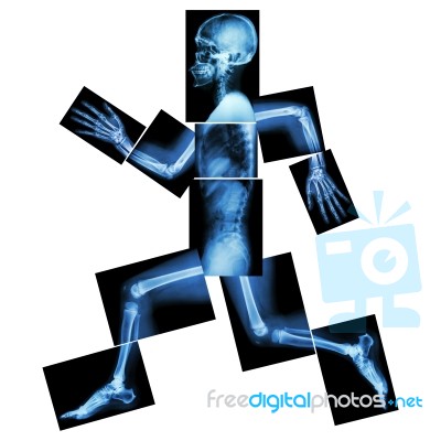 Aerobic Exercise (human Bone Is Running) ,(whole Body X-ray : Head ,neck ,shoulder ,shoulder ,arm ,elbow ,forearm ,hand ,finger ,joint ,thorax ,abdomen ,back,pelvis ,hip ,thigh ,leg ,knee ,foot ,heel) Stock Photo