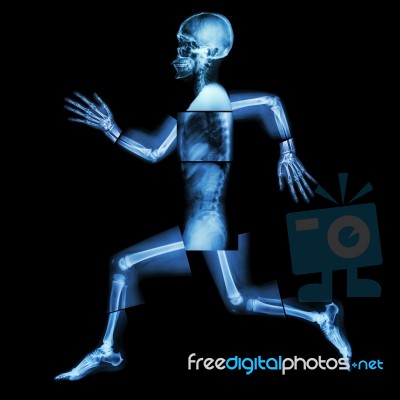 Aerobic Exercise (human Bone Is Running) ,(whole Body X-ray : Head ,neck ,shoulder ,shoulder ,arm ,elbow ,forearm ,hand ,finger ,joint ,thorax ,abdomen ,back,pelvis ,hip ,thigh ,leg ,knee ,foot ,heel) Stock Photo