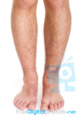 Ankle Sprain Stock Photo