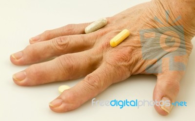 Arthritic Fingers Stock Photo