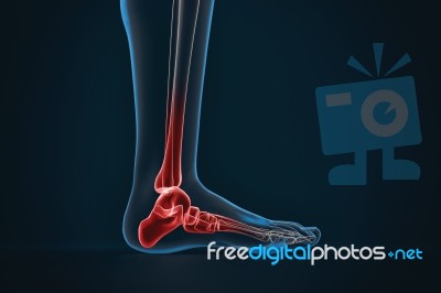Arthritis Of Ankle. X-ray Of Foot. Lateral View Stock Image