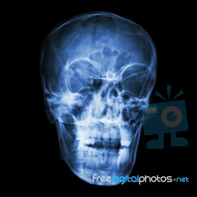 Asian People's Skull (thai People) Stock Photo