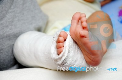 Baby Foot In Bandage And Cast Stock Photo