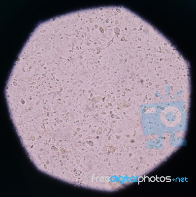 Bacteria In Urinary Tract Infections Stock Photo
