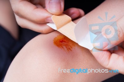 Child Knee With A Plaster (for Wounds) And Bruise Stock Photo