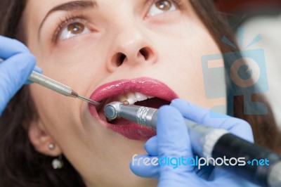 Close-up Medical Dentist Procedure Of Teeth Polish Stock Photo Close-up Medical Dentist Procedure Of Teeth Polish Stock Photo