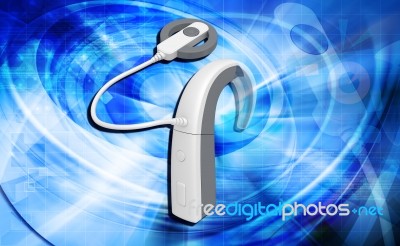 Cochlear Implant Stock Image Cochlear Implant Stock Image