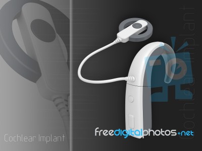 Cochlear Implant Stock Image