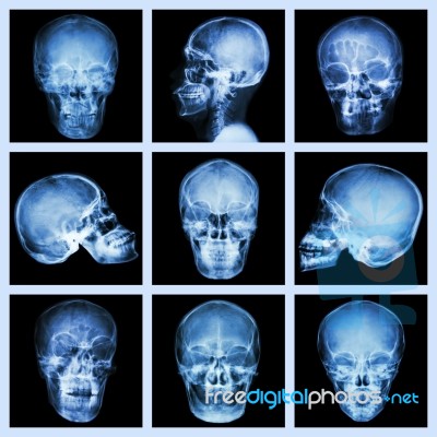 Collection Of Asian Skull Stock Photo