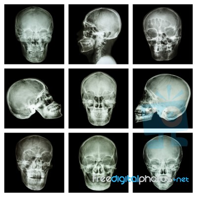 Collection Of Asian Skull Stock Photo