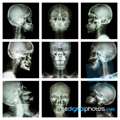 Collection Of Asian Skull (thai People) Stock Photo