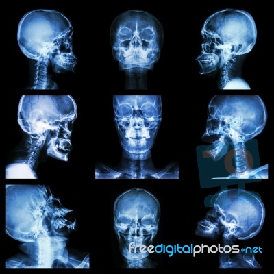 Collection Of Asian Skull (thai People) Stock Photo