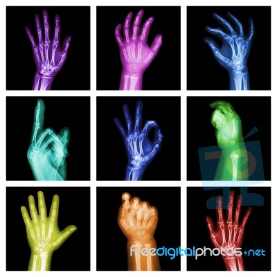 Collection Of Colorful X-ray Hands Stock Photo